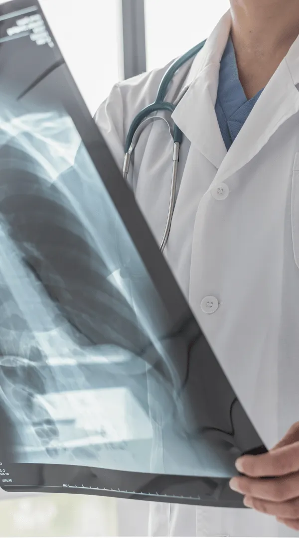 Medico radiologo esamina una radiografia del torace